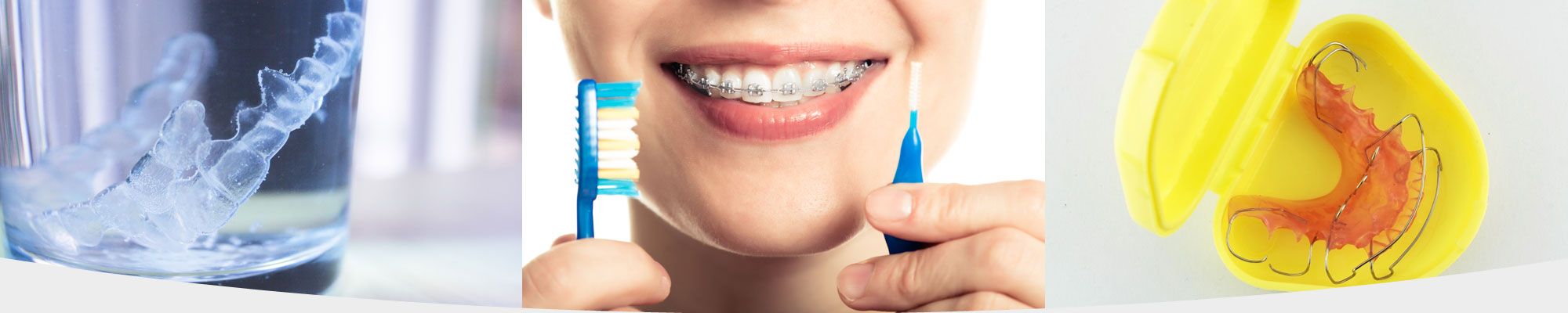 Examples of taking care of dental braces