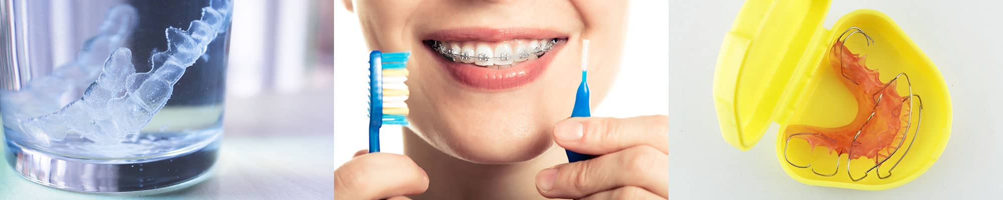 Range of dental braces