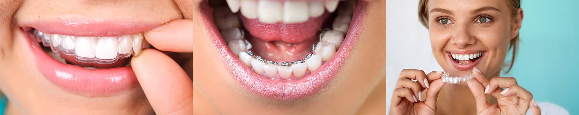 Patients in St Helens wearing less visible braces