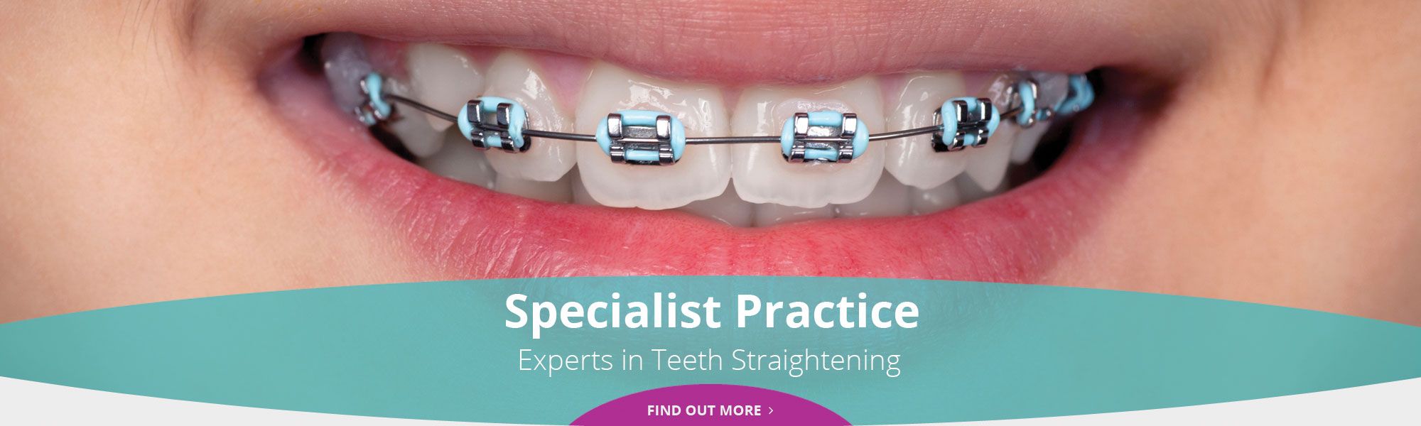 Specialist Practice - Experts in Teeth Straightening - Find out more