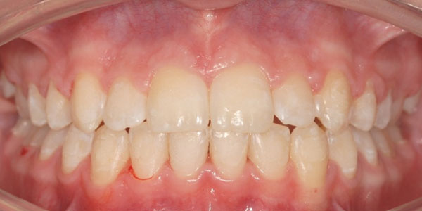 Patient after dental treatment