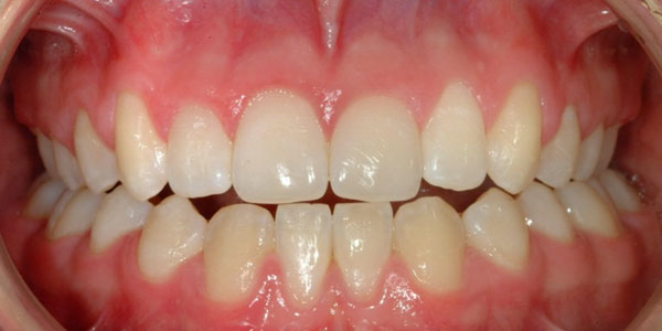 Patient after dental treatment