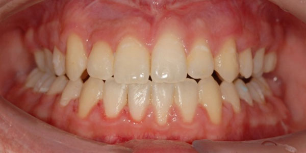 Patient after dental treatment
