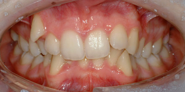 Patient before dental treatment