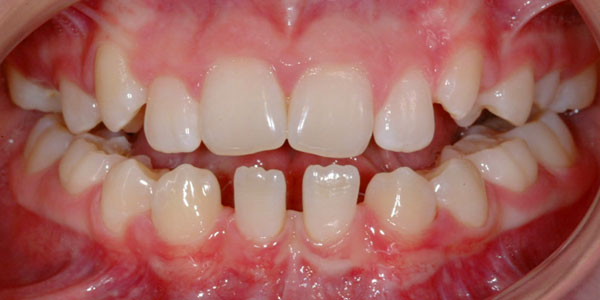 Patient before dental treatment