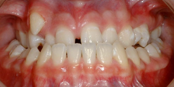 Patient before dental treatment