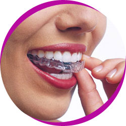 Lady with Invisalign brace